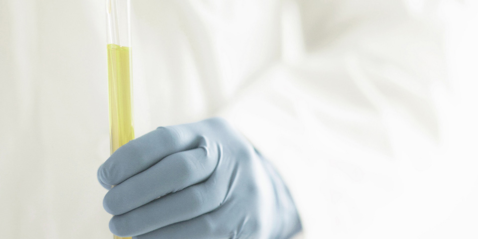 ACS Nano：突破！科學家利用來自尿液的生物標志物進行早期癌癥篩查